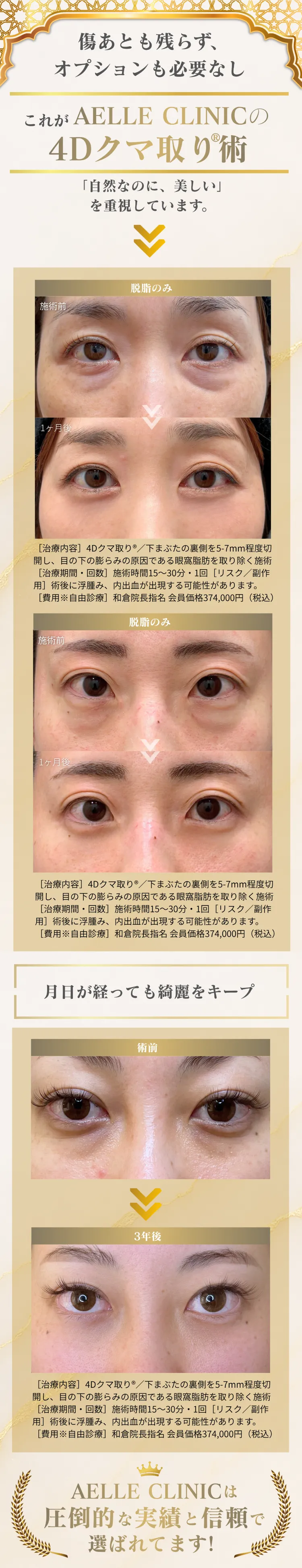 実績と信頼で選ばれるAELLE CLINIC。脱脂のみ症例・3年後の経過症例で自然な仕上がりをキープ