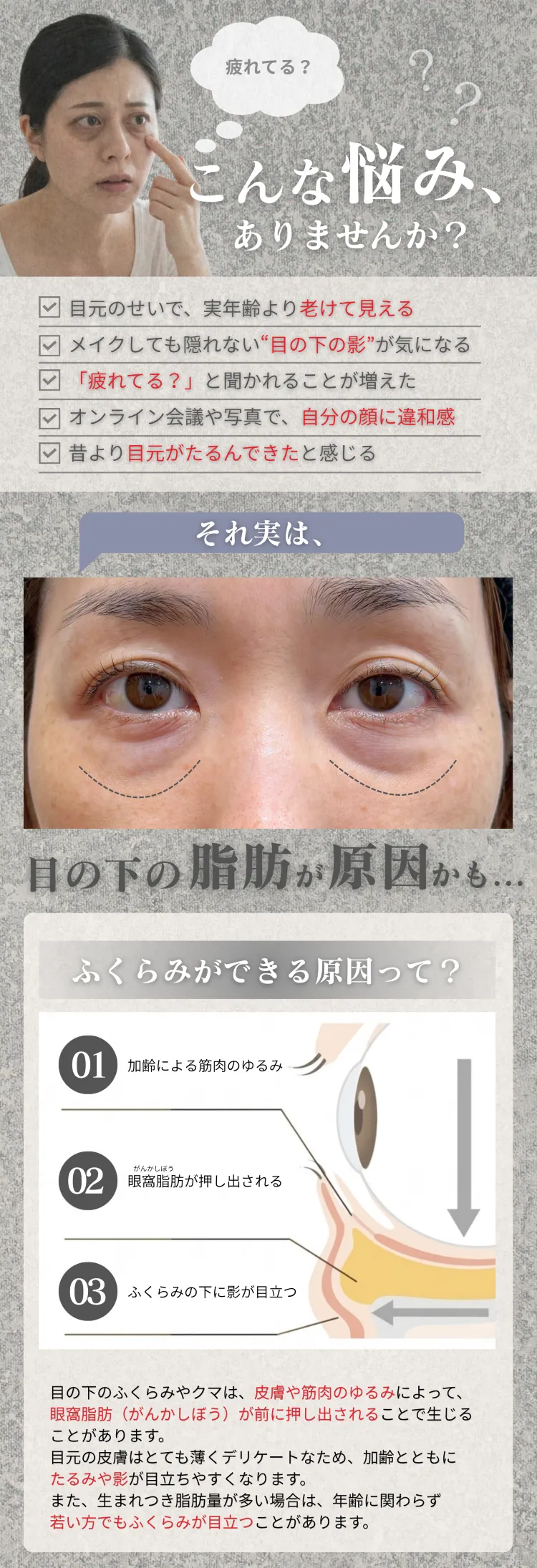 こんな悩み、ありませんか？ 目元のせいで老けて見える・目の下の影・たるみ — 原因は眼窩脂肪（加齢による筋肉のゆるみ→脂肪が押し出される→影が目立つ）