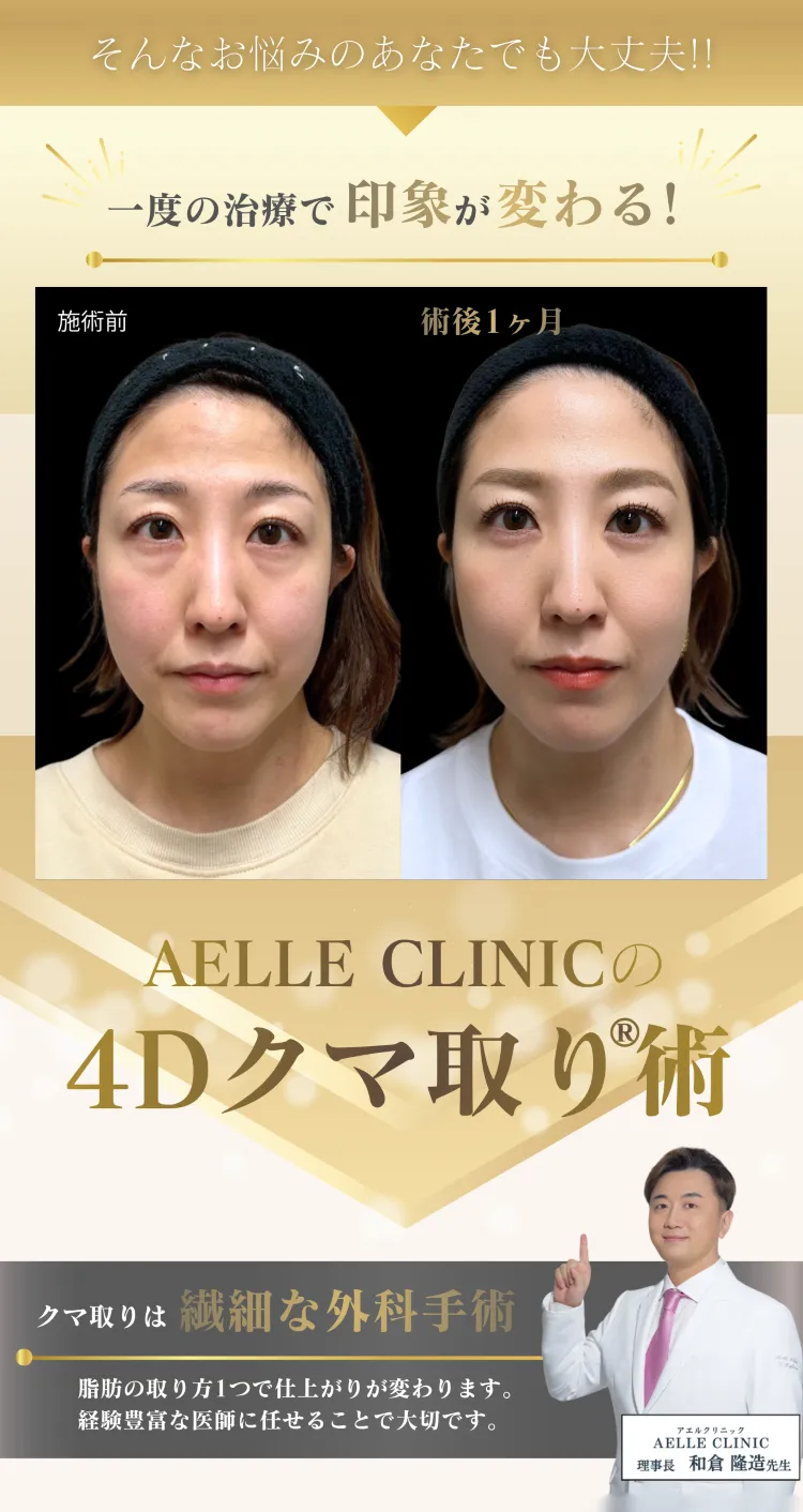 一度の治療で印象が変わる — AELLE CLINICの4Dクマ取り®術 施術前と術後1ヶ月の比較 / クマ取りは繊細な外科手術 理事長 和倉隆造医師