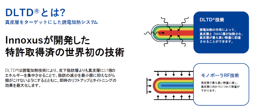 DLTD®とは？真皮層をターゲットにした誘電加熱システム
