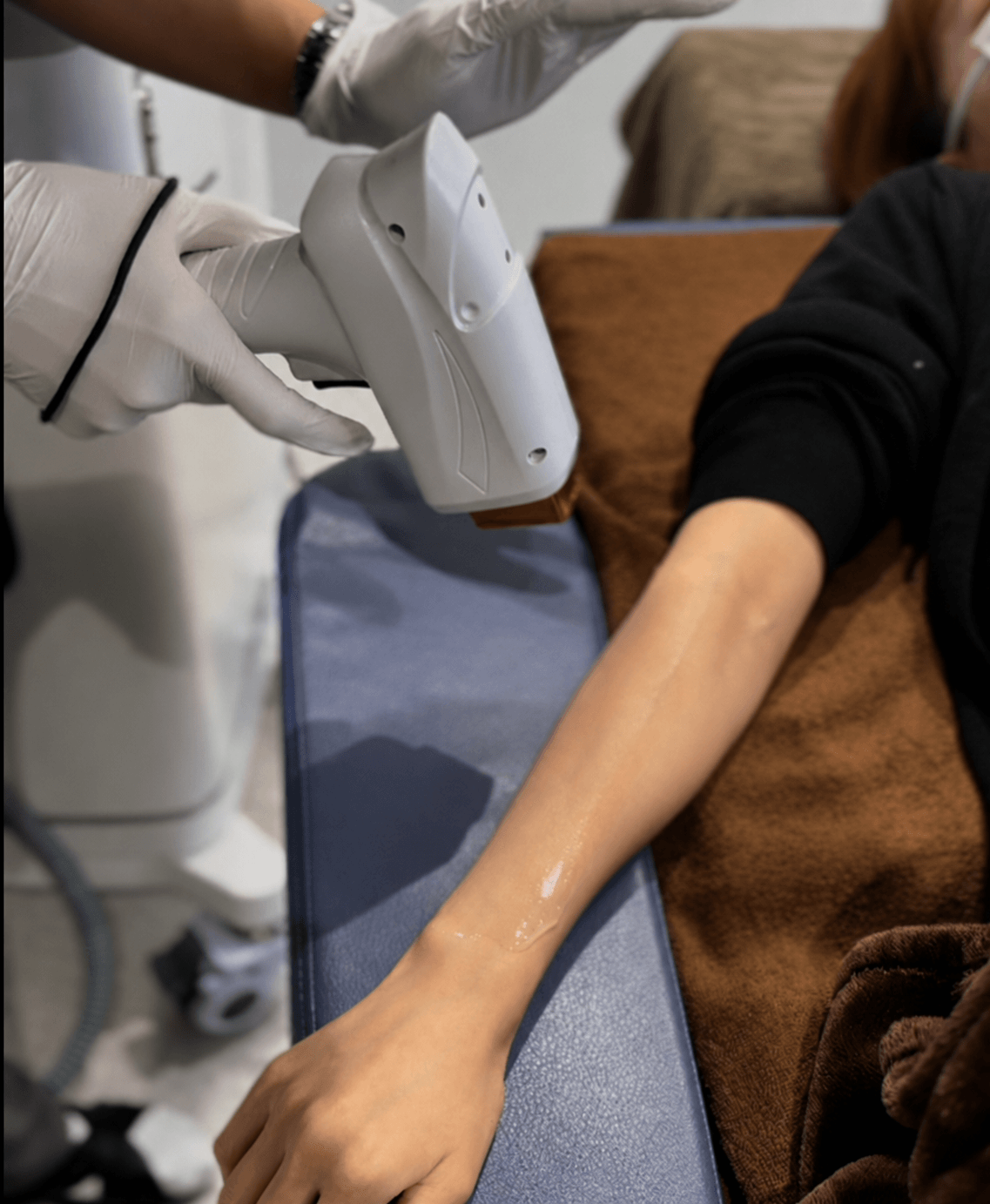モータスのハンドピースで腕に照射している施術の様子