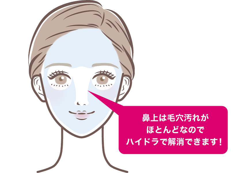 顔の脱毛範囲を示した顔のイラスト