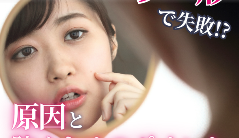 クマ取り 整形 失敗に関するコラム記事のアイキャッチ画像。鏡を見て目の下を気にする女性の写真