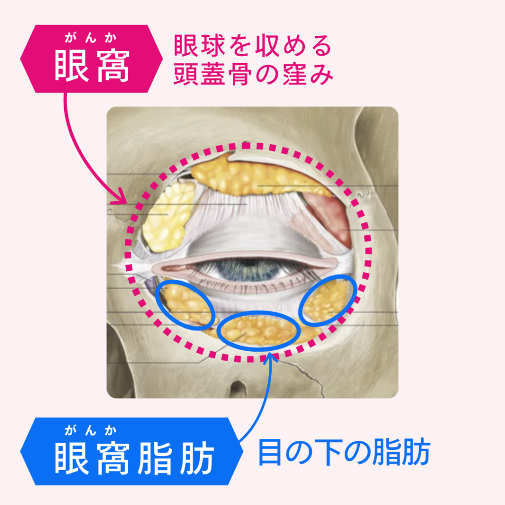 眼窩・眼窩脂肪の位置を示した図解