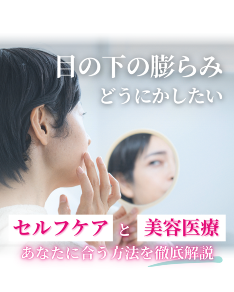 目の下 の 膨らみに悩む女性