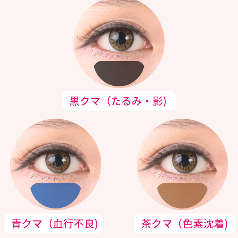 クマの種類と原因一覧