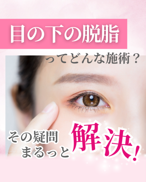 目の下の脱脂とはどんな施術かを解説するアイキャッチ画像