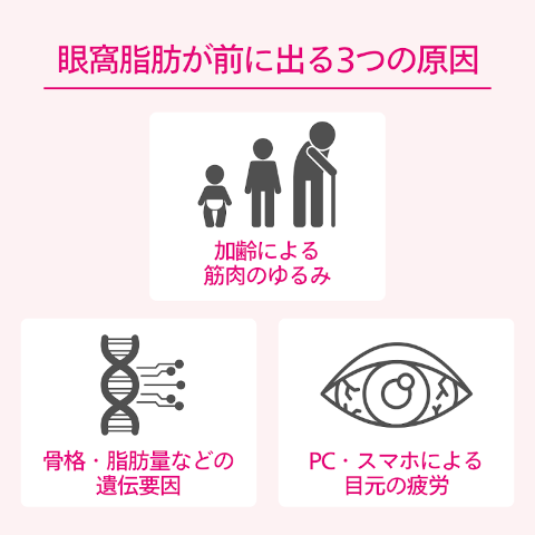 眼窩脂肪が前に出てきてしまう3つの主な原因
