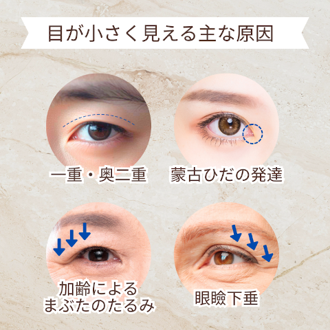 目が小さく見える原因
