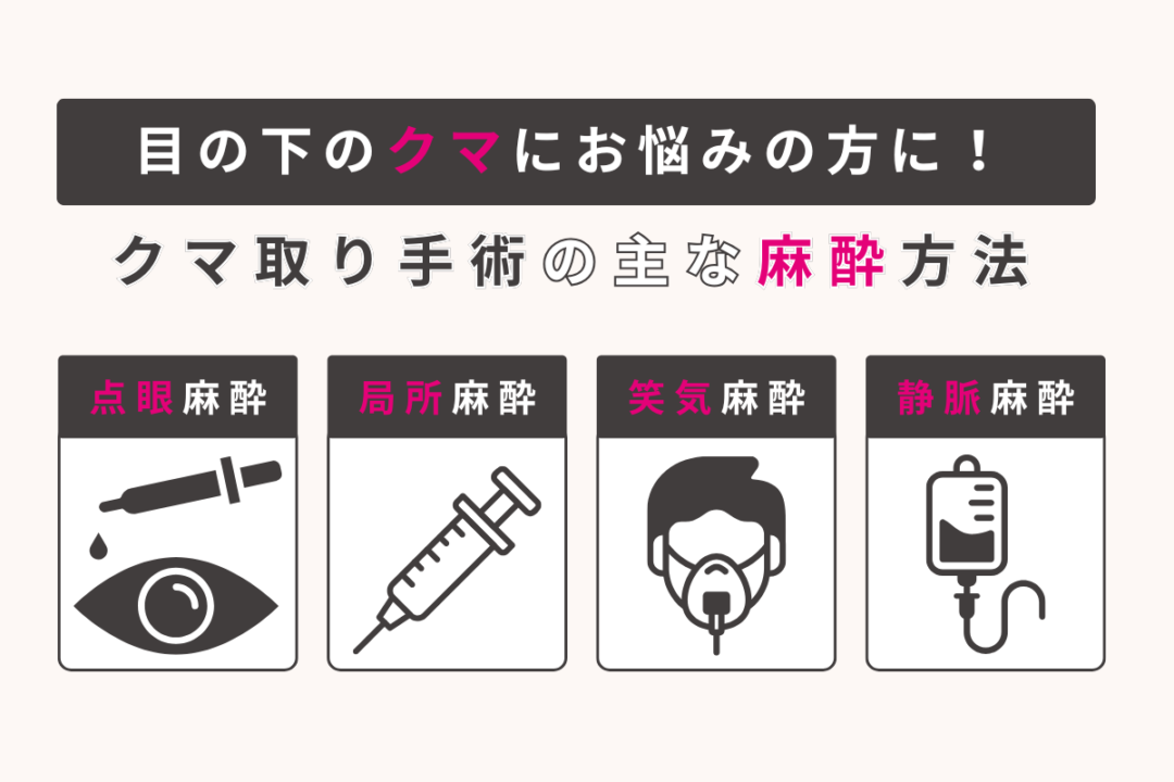 クマ取りで行う4つの麻酔方法を示した図