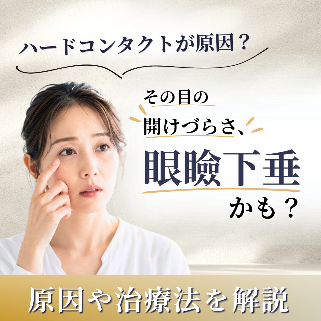 ハードコンタクトで眼瞼下垂に？原因や対策｜AELLE CLINIC（アエルクリニック）