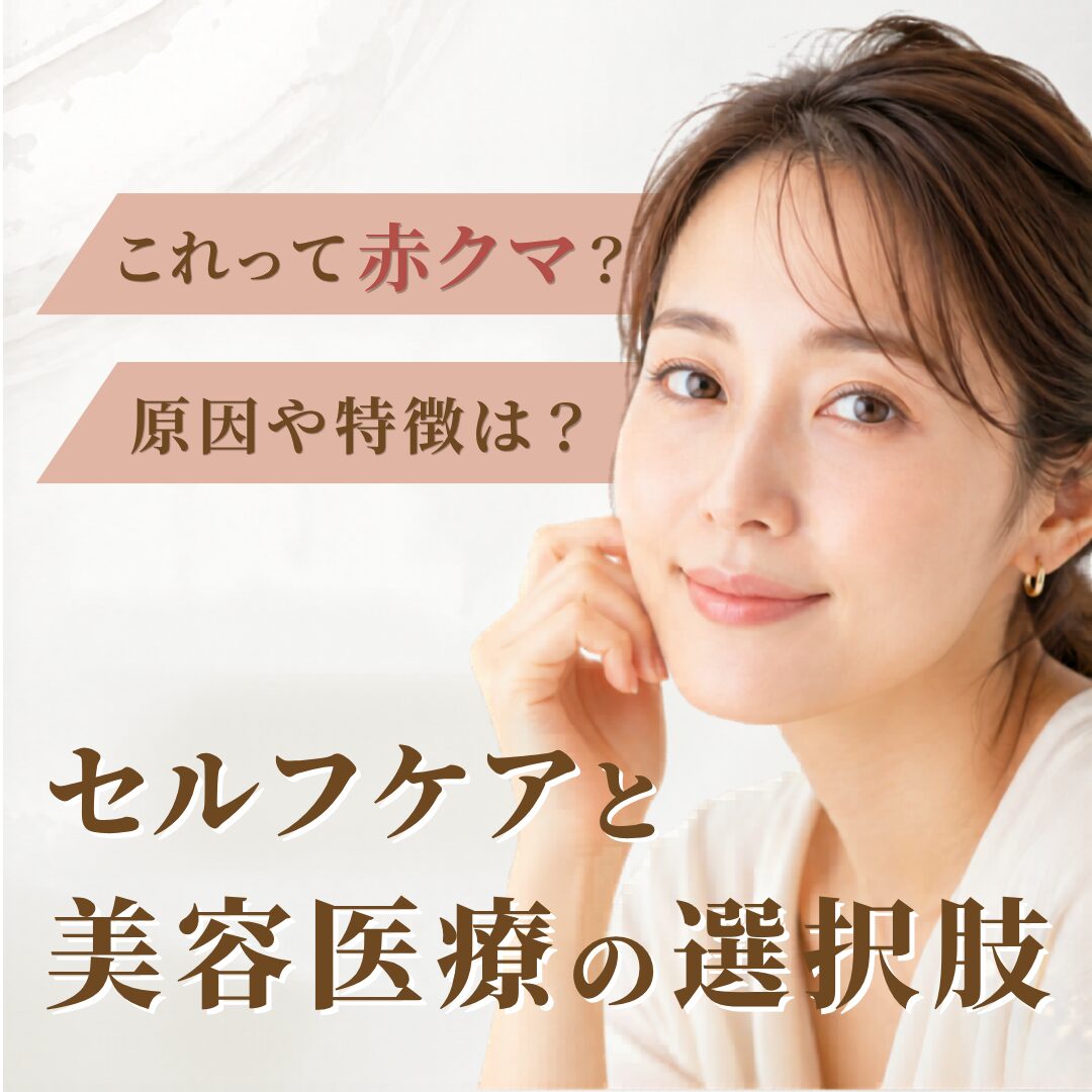 赤クマの特徴と原因を解説!アプローチ方法も|AELLE CLINIC(アエルクリニック)