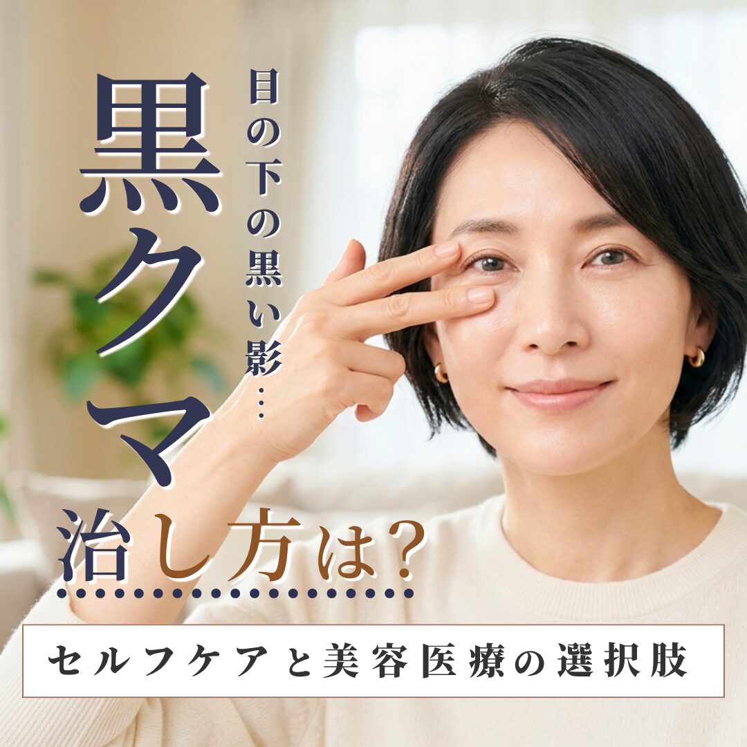黒クマの治し方や原因を徹底解説｜AELLE CLINIC（アエルクリニック）