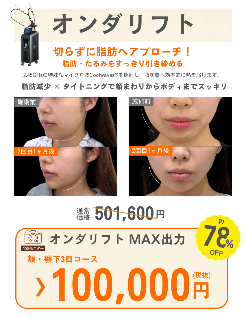 オンダリフト 3回コース 税抜100,000円。全顔モニター・施術前後の症例写真。