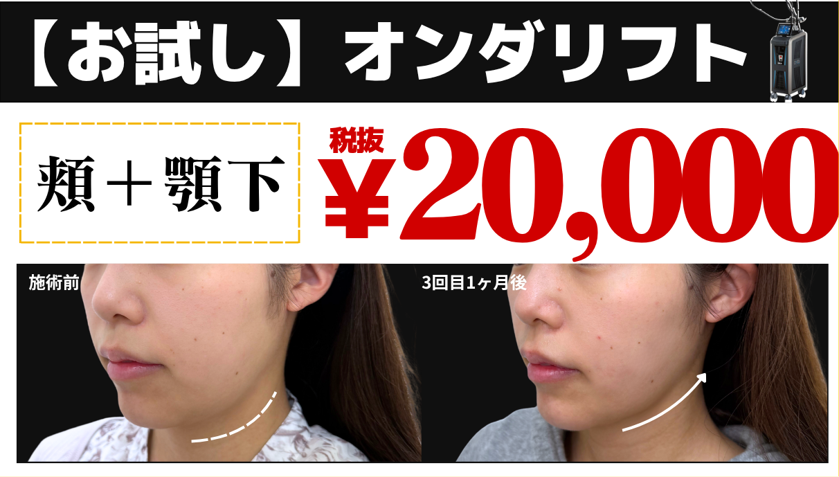お試しオンダリフト