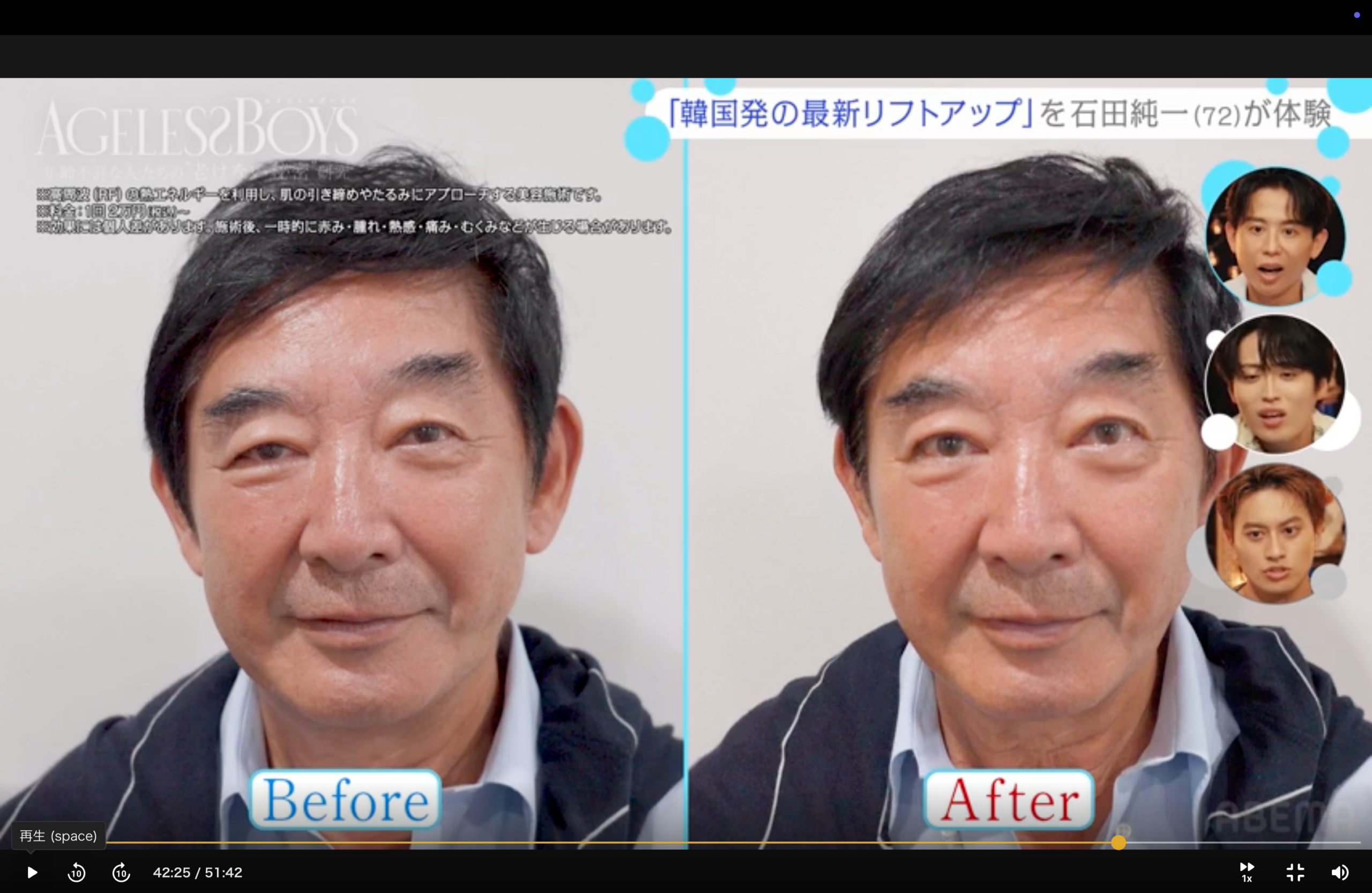 石田純一さんのオールタイト施術前後。左が施術前、右が施術後。ABEMA番組内より